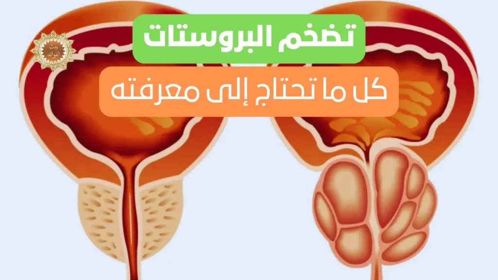علاج تضخم البروستات