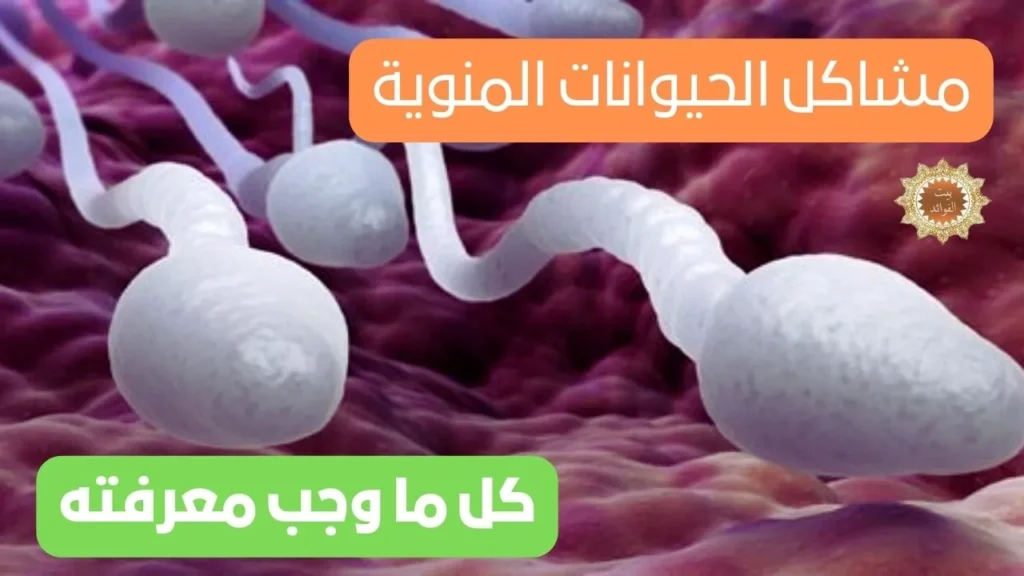 مشاكل الحيوانات المنوية
